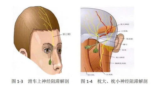 病例分享 癫痫病灶切除术 术中唤醒麻醉