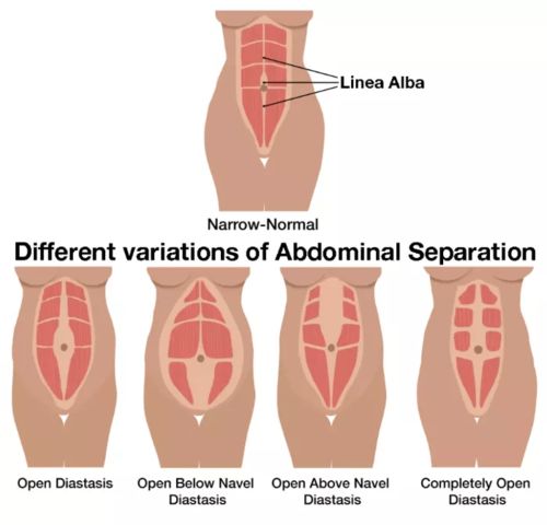 满月发汗,卵巢保养,骨盆修复 这些雷区要避开
