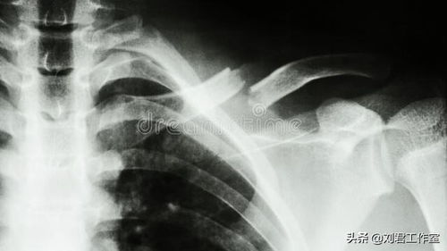 揭露 美军历史上真实发生的十大恐怖 人体实验