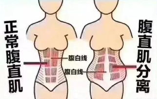 正骨窍要,全在摸法